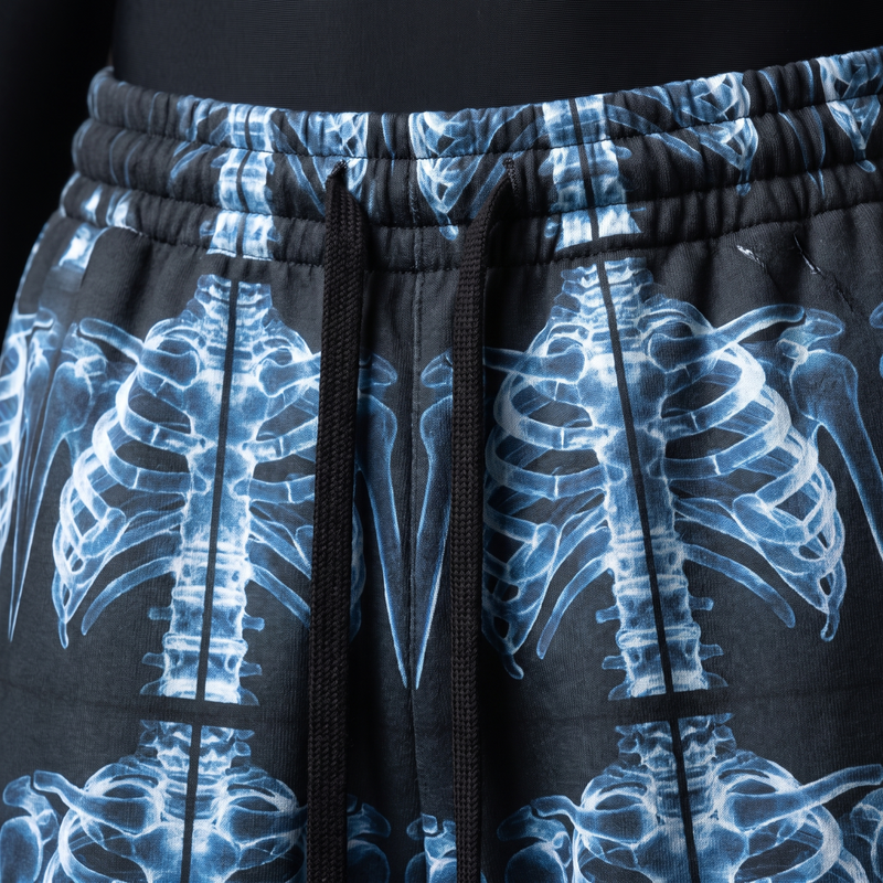X-Ray Ribcage Baggy Pants